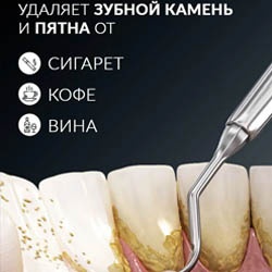Ультразвуковой зубной скалер S501 от AsiaCare - сам себе домашний стоматолог. Фото было-стало
